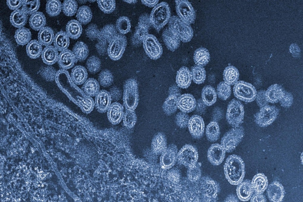 Fourth case of H7N9 bird flu confirmed in 3 weeks
