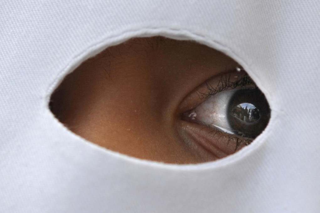 Signs can be evident months after birth. Photo: AFP