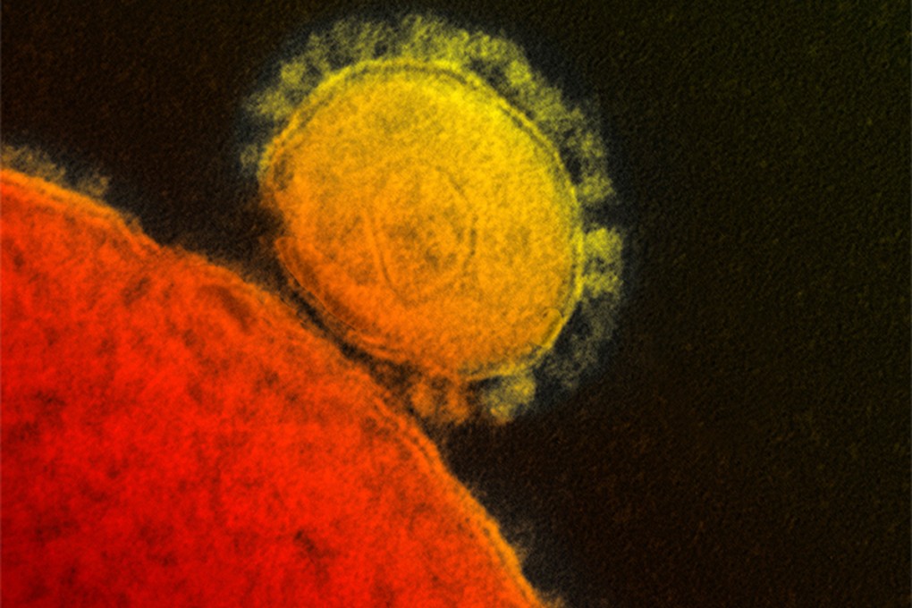 An electron microscope image of the Mers virus, which appears to be more deadly than Sars. Photos: AP; AFP; David Wong; Corbis; Martin Chan; Edward Wong