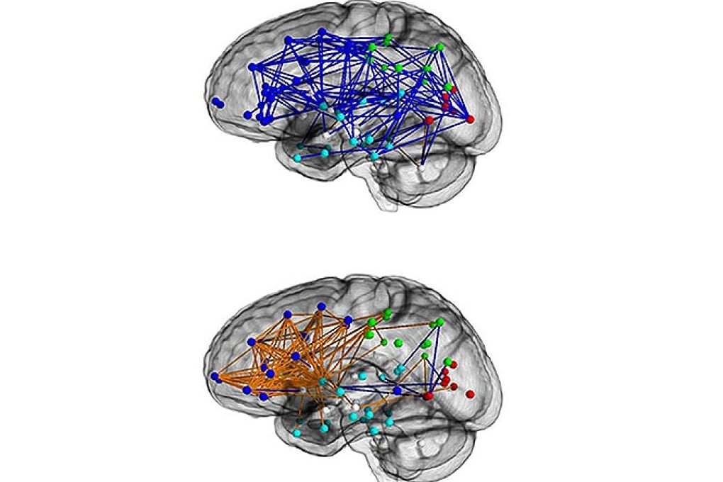 A neural map of a typical man's brain (top) and that of a woman.