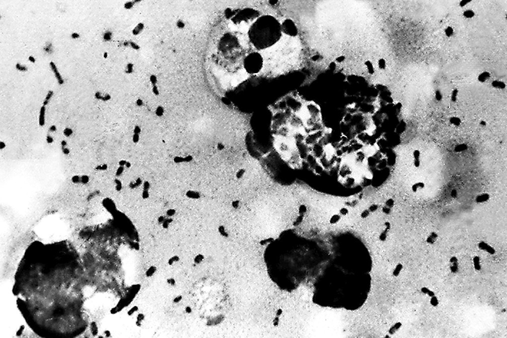 Bubonic plague bacteria. Photo: AFP