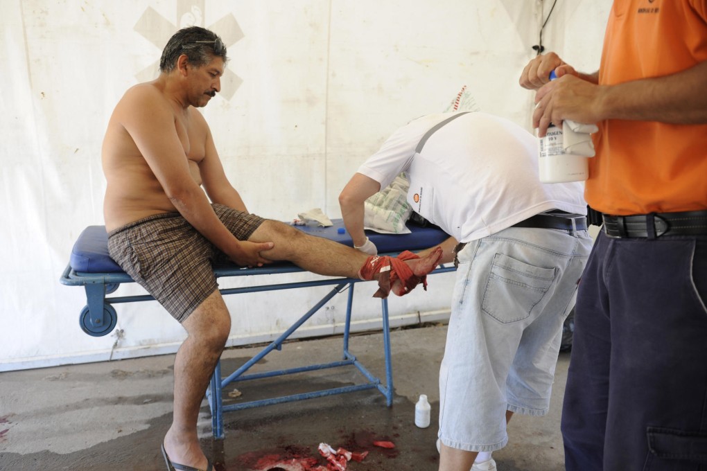 A man is treated after being bitten by palometas. Photo: AP