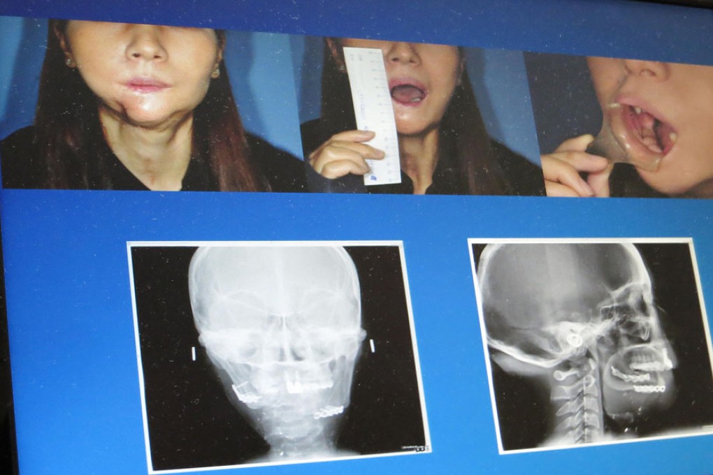 X-rays and photographs of Yik Siu-ling before her treatment.