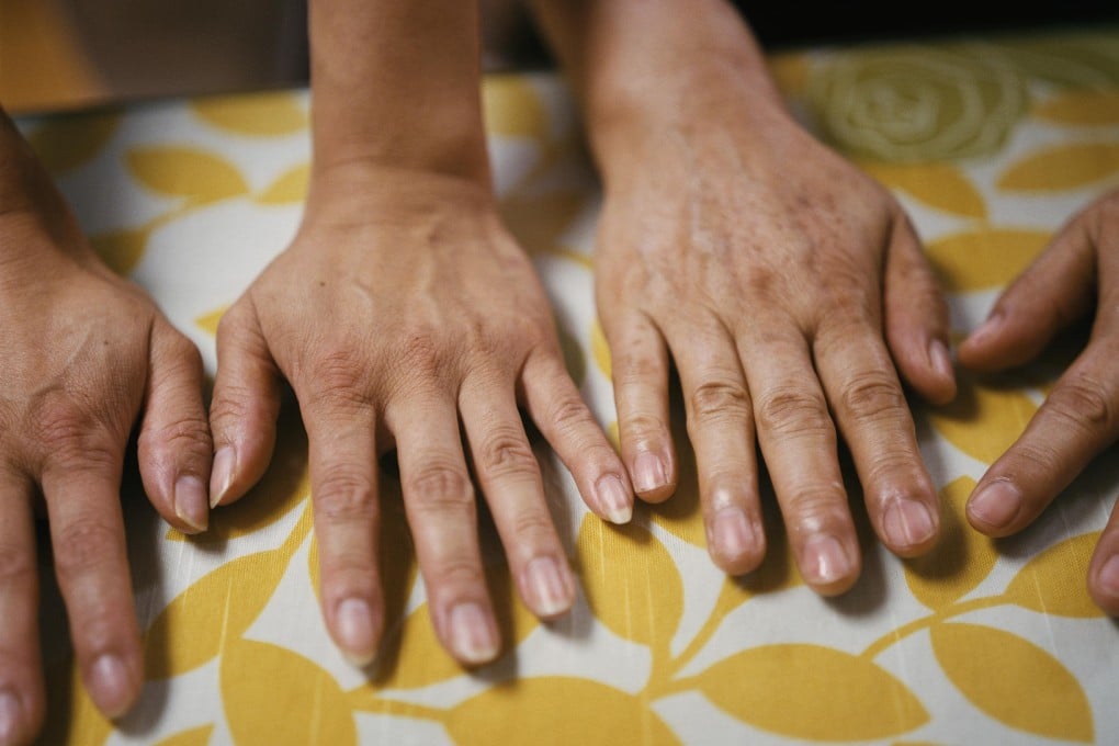 Yang Hay-suk and Laure, the daughter she gave up for adoption when she was 15 months old, compare hands.