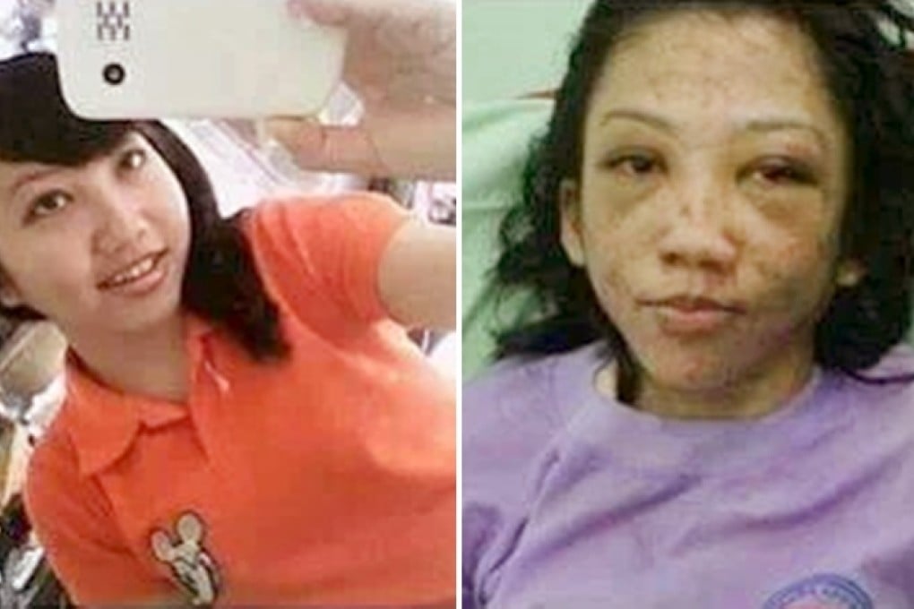 A combination photo of screenshots from Facebook showing Erwiana Sulistyaningsih before and after her injuries. Photo: SCMP Pictures
