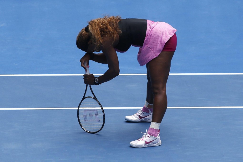 serena williams shock drop