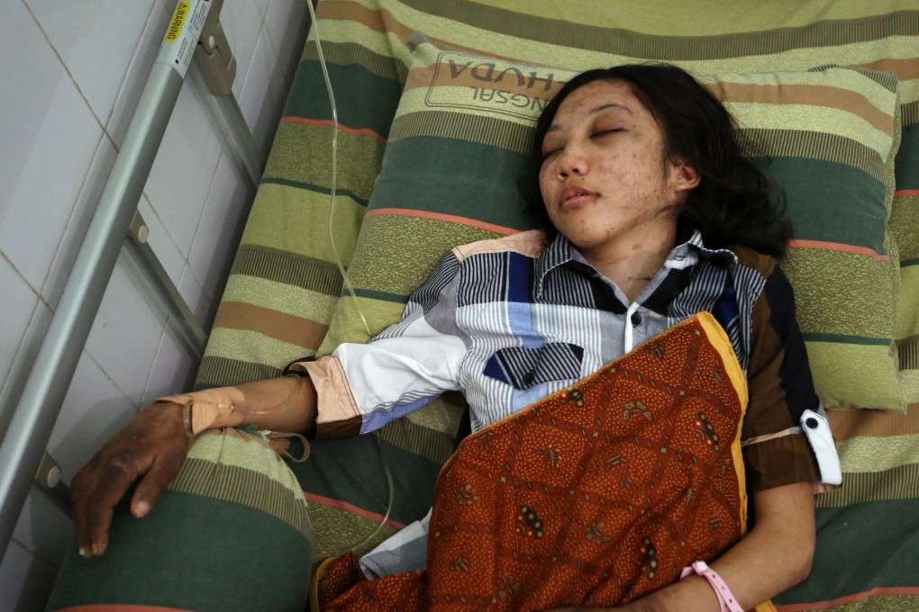 Injured domestic helper Erwiana Sulistyaningsih. Photo: Sam Tsang