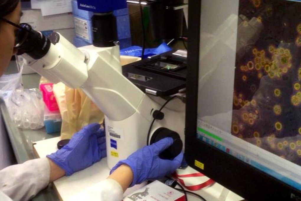 A laboratory scientist monitors algae activity under a microscope. One millilitre of water can contain 10 million algae after a single day.
