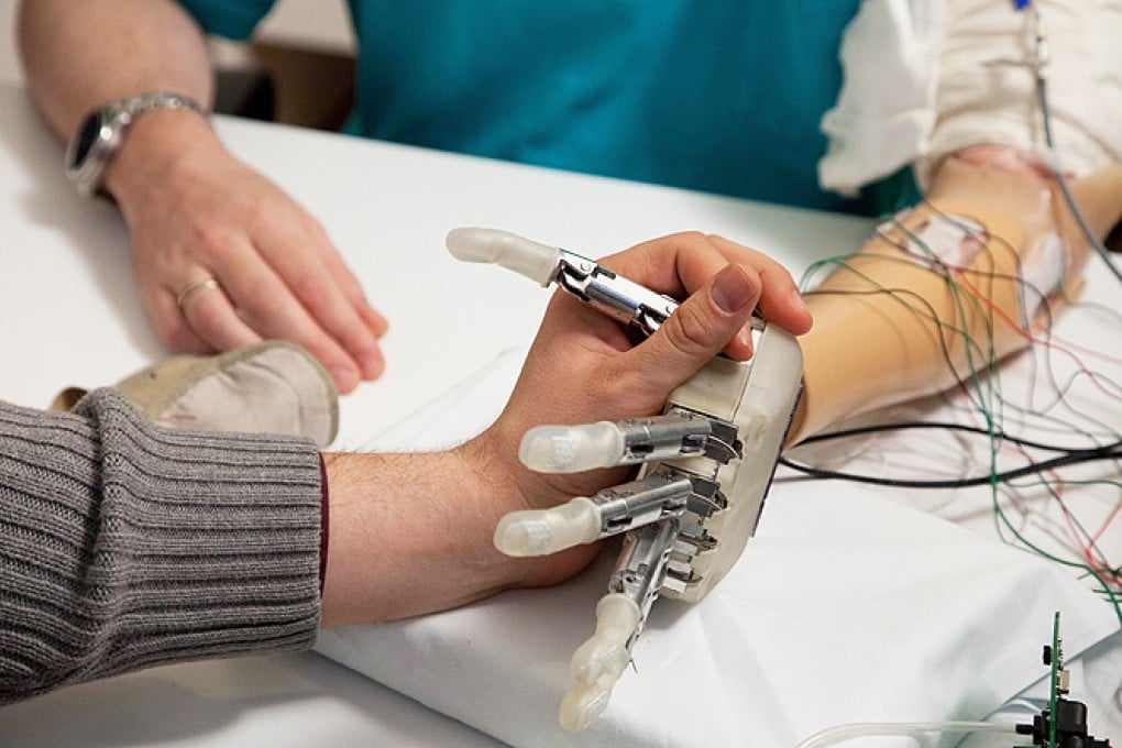 Amputee Dennis Sorensen wears a sensory feedback prosthesis
during experiments conducted at a hospital in Rome. Photo: AFP
