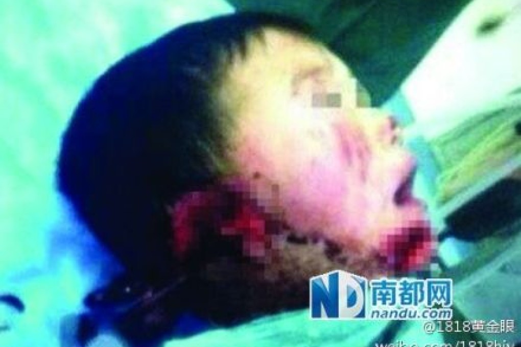A photo of the six-year-old  showing gory injuries he suffered has gone viral on social media. Photo: screenshot via Weibo