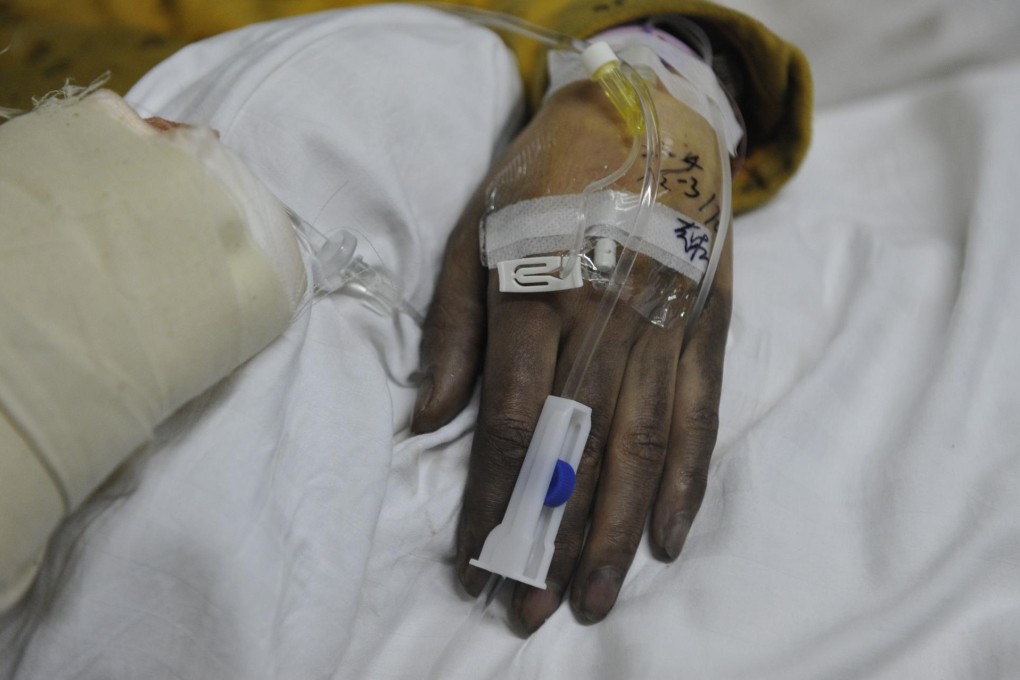 A person is treated at hospital after being injured in Thursday's bus fire in Guiyang in Guizhou province. Photo: Xinhua