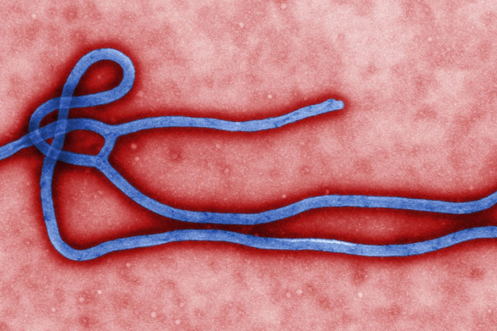 The Ebola virus as seen through an electron microscope. Photo: EPA