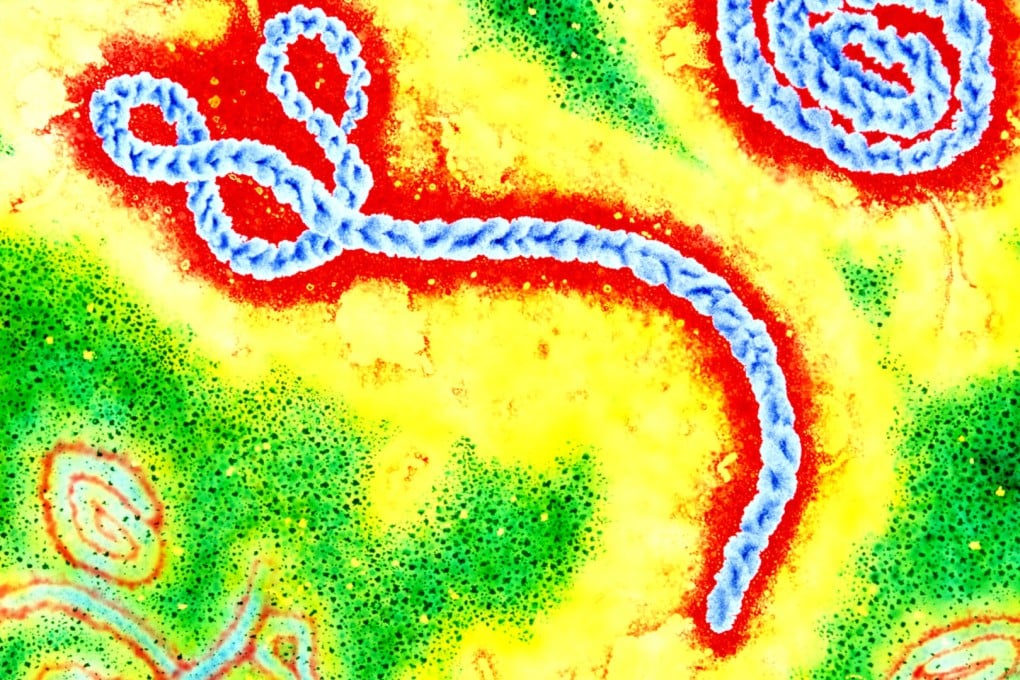 The virus under an electron microscope. Ebola outbreaks are relatively rare, and of little interest to drugmakers. Image: SCMP