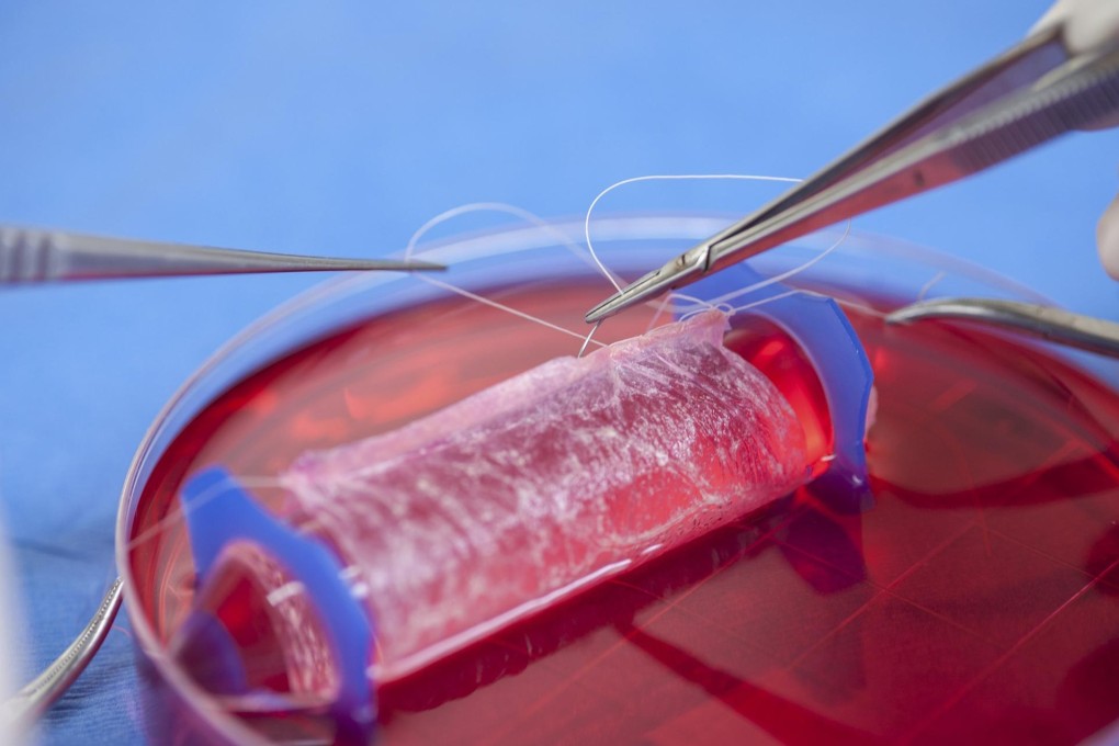Cells taken from the patients themselves formed the basis of the lab-grown organs. Photo: Reuters