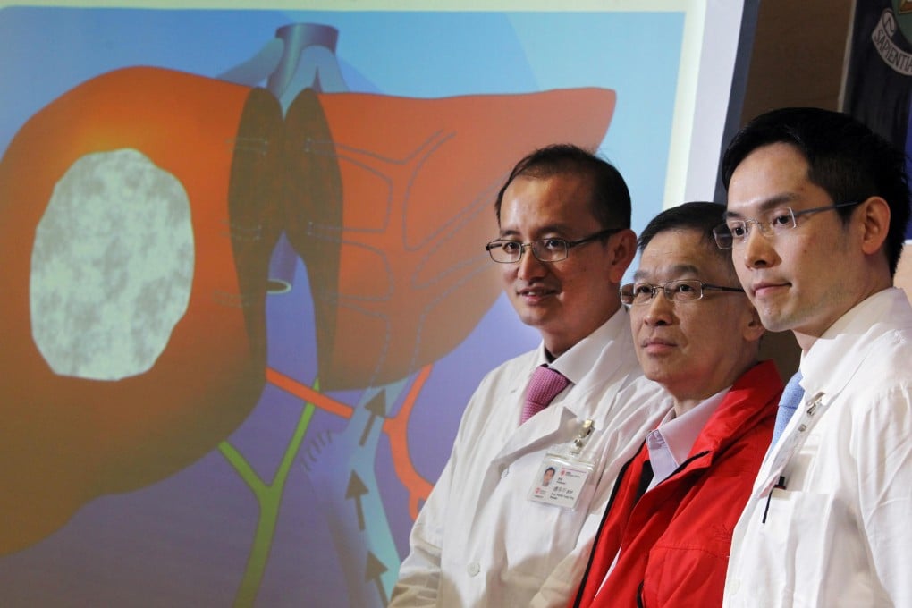 Professors Ronnie Poon (left) and Albert Chan flank patient Chiu Kam-wing in front of a picture of the two lobes. Photo: Dickson Lee