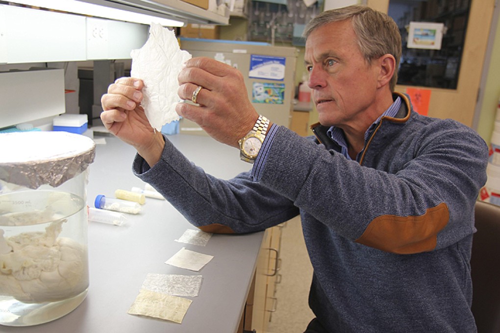 Dr Stephen Badylak of the University of Pittsburgh holds a sheet of extracellular matrix, which is derived from pig bladder. Photo: Reuters