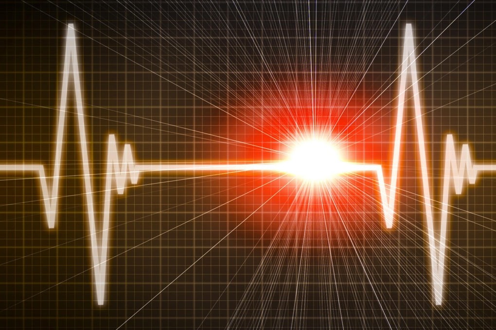 Defibrillators shock the heart back to normal rhythm to avert the possibility of sudden cardiac arrest.