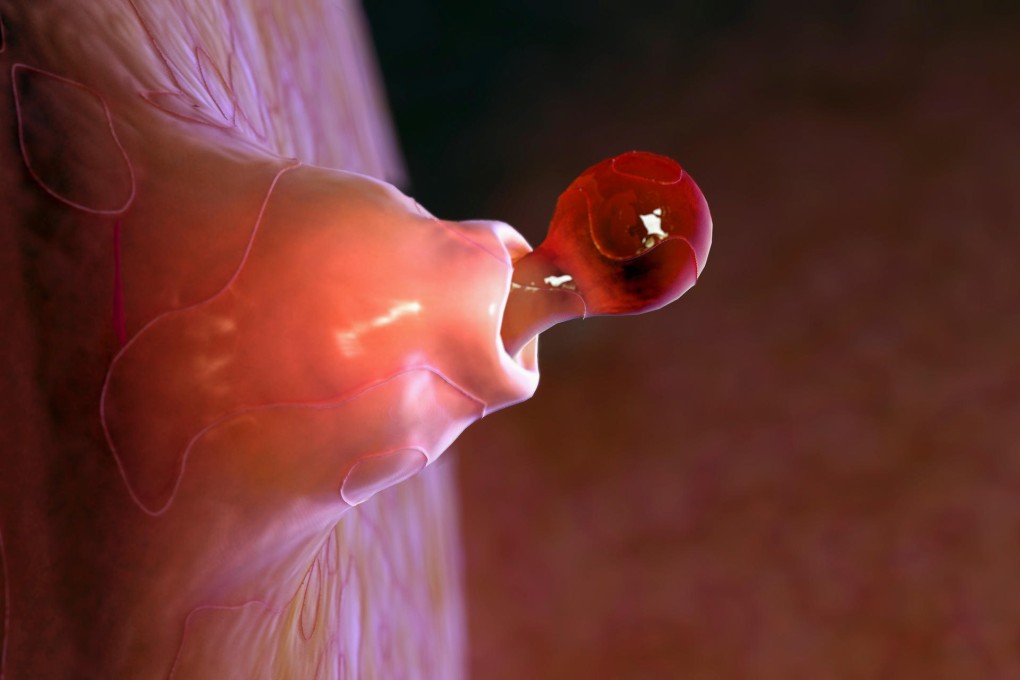 The process of ovulation inside a female body. Photo: Corbis
