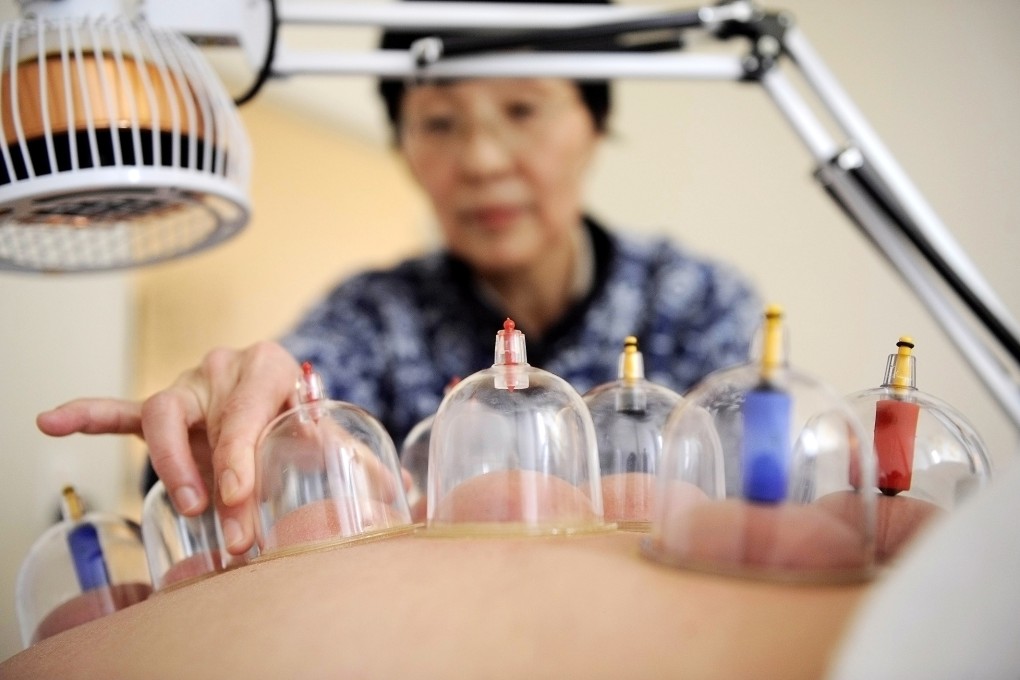 A traditional Chinese medicine practitioner uses heated cups to treat a patient's bronchitis. Some TCM doctors are reportedly paid paltry sums for a day's work, according to a top public hospital official in Fuzhou. Photo: AFP