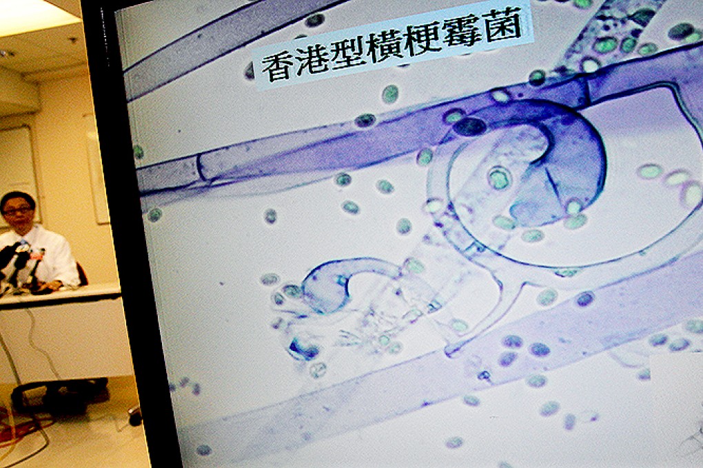 Dr Ho Pak Leung of the Microbiology Department at Queen Mary Hospital gives a press conference on the recently discovered fatal bug "Lichtheimia hongkongensis". Photo: David Wong