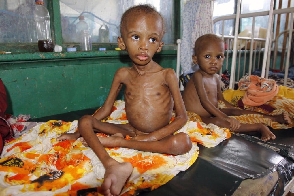Malnourished children at Banadir Hospital, in Mogadishu, Somalia. A group of charities are appealing for US$822 million. Photo: AP