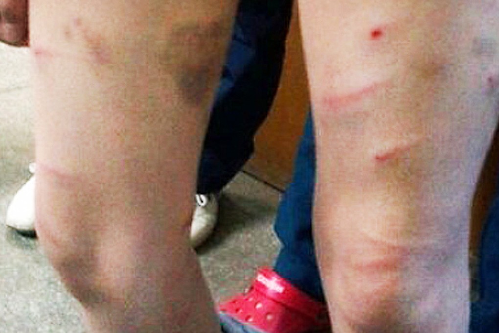 Photos of the beaten boy were reposted over 40,000 times online. Photo: SCMP