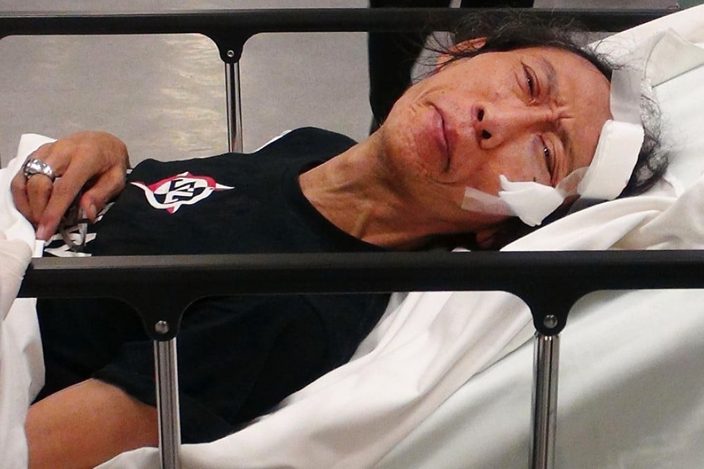 Lee Wen suffered no serious injuries. Photo: SCMP