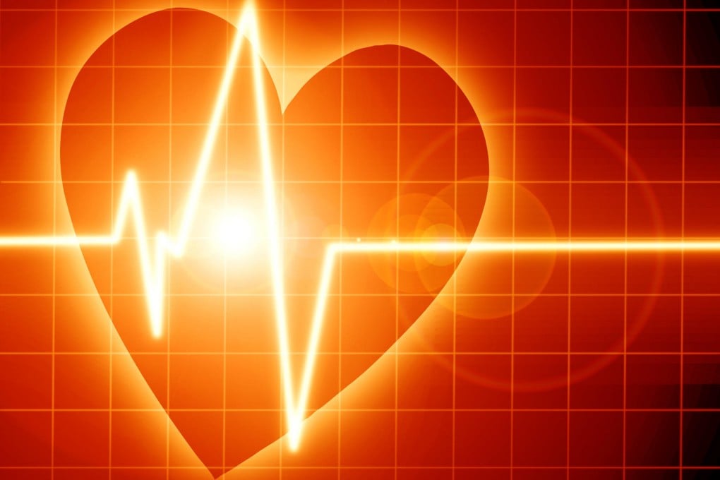 Health questions: do heart attack symptoms always include chest pain?