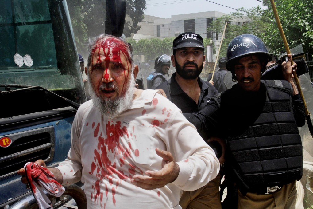 Pakistani policemen arrest an injured protester in Lahore. Photo: AP