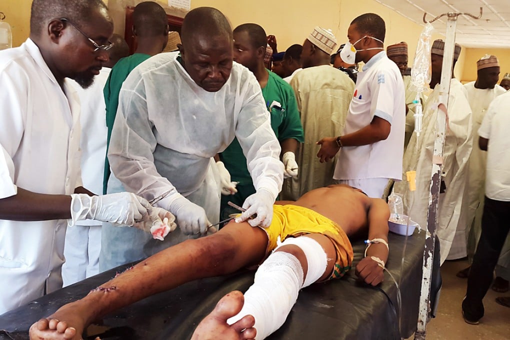 Medical personnel attend to a survivor of a bomb blast at a world cup viewing at Sani Abacha medical centre in Damaturu. Photo: Reuters