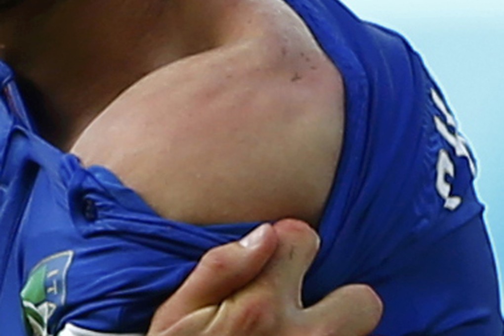 Italy's Giorgio Chiellini shows his shoulder, claiming he was bitten by Uruguay's Luis Suarez. Photo: Reuters