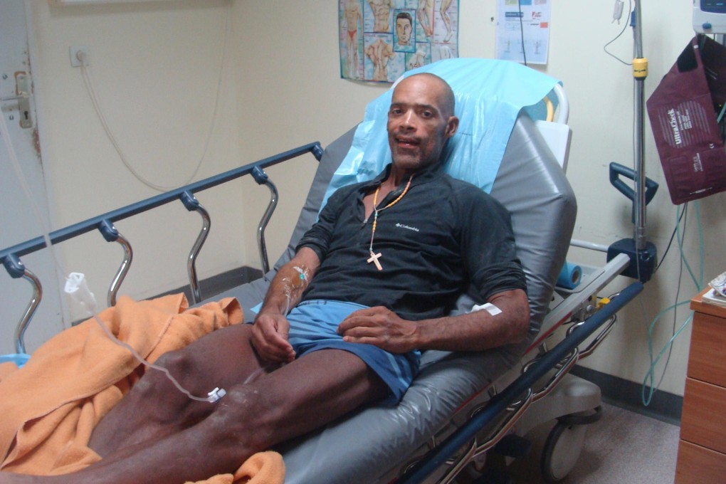 Victor Mooney recovers in a hospital bed on the Dutch Caribbean island of St Maarten after finally achieving his dream of rowing across the Atlantic. Photo: AP