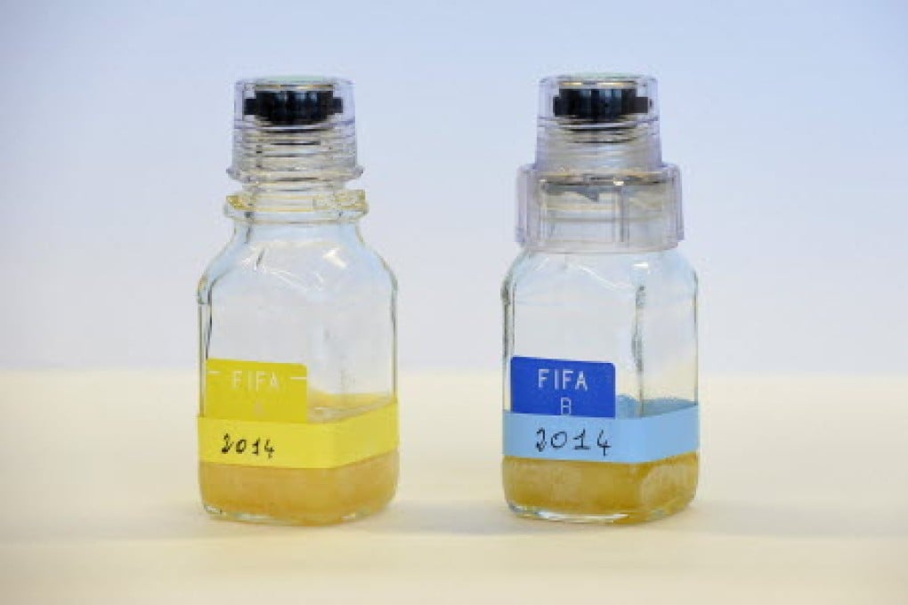 Some believe that drinking urine can help the body grow stronger and even cure conditions like hyperthyroidism. Photo: EPA