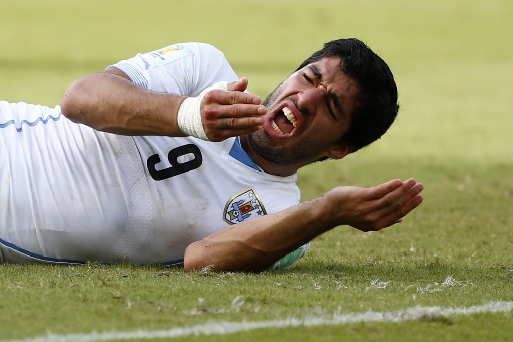 Uruguay's Luis Suarez reacts after biting Italy's Giorgio Chiellini during their match at the Dunas arena in Natal on June 24. Photo: Reuters