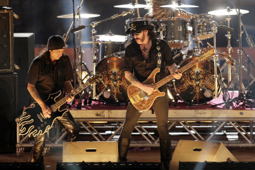 Motorhead in concert. German doctors say they have treated a fan whose headbanging habit ultimately led to a brain injury. Photo: AP