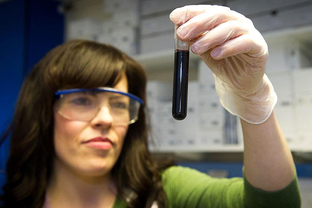 Blood proteins can predict dementia in people with MCI, but more research is needed. Photo: SCMP