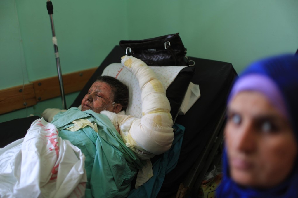 Nanny Salwa Abu Qumsan at a hospital in Gaza. Photo: Xinhua