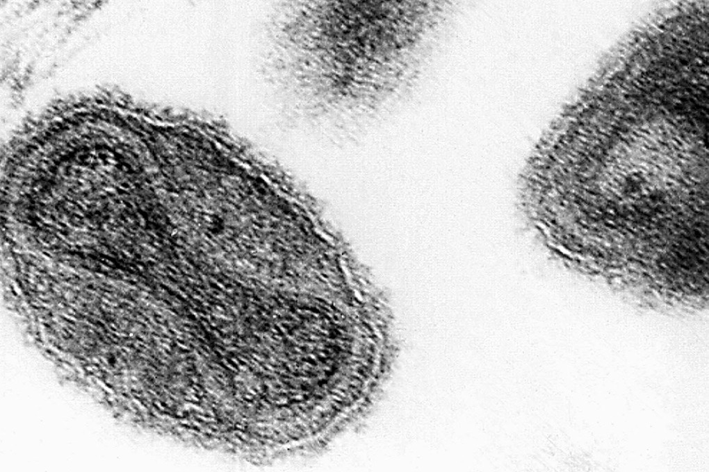Smallpox virus seen under an electron micrograph. Photo: AP