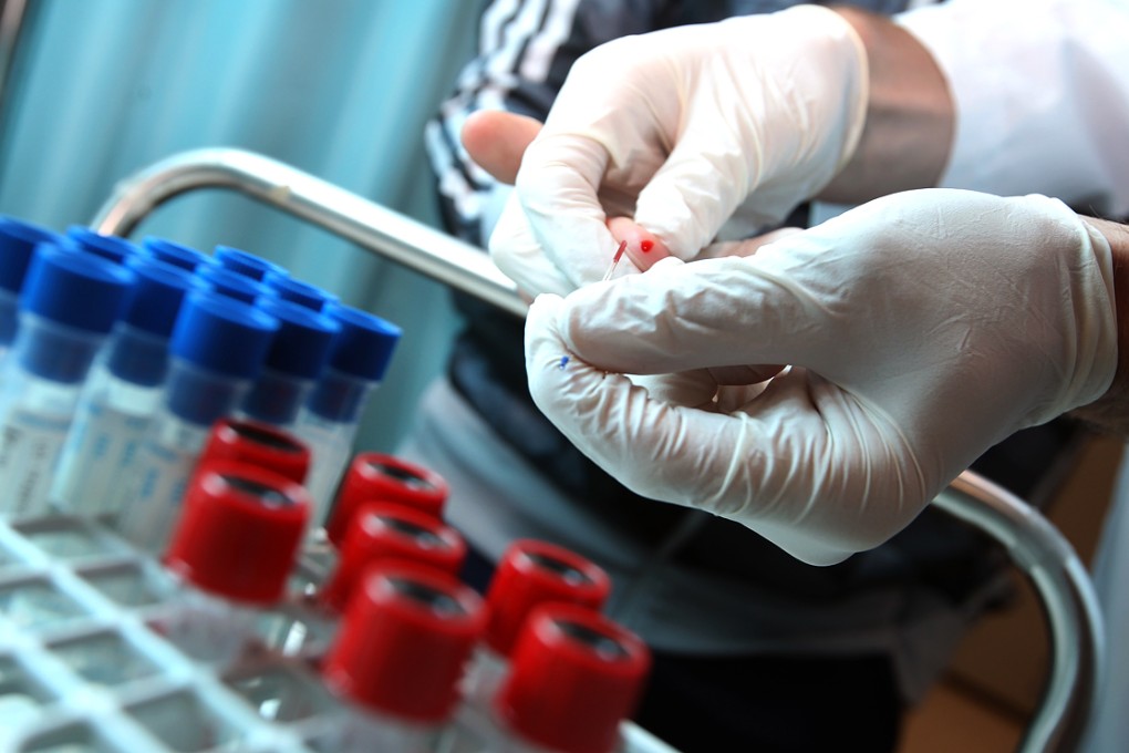 The researchers were able to guess with 80 to 90 per cent accuracy whether a person had thoughts of suicide or made an attempt, by looking at the single gene from the blood test. Photo: Felix Wong