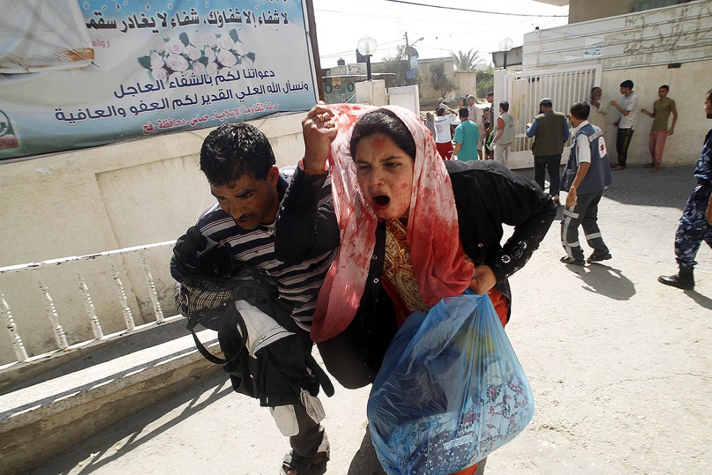 A wounded Palestinian woman arrives at al-Najar hospital in the southern Gaza Strip. Photo: AFP
