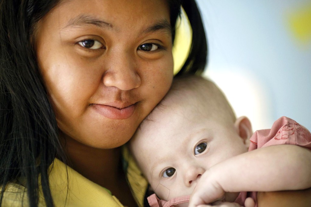 Gammy with his mother in Thailand. Photo: Reuters