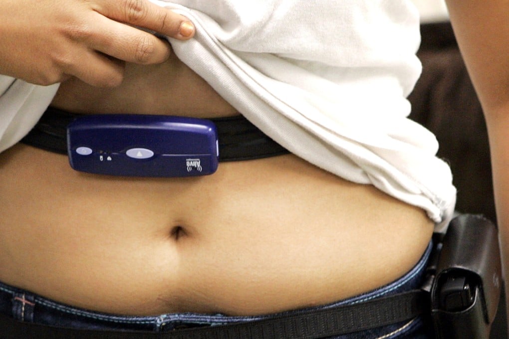 Higher BMI also increased the risk of cancer of the liver, colon, ovaries and breast, although the effect on these types was influenced by other factors. Photo: AP