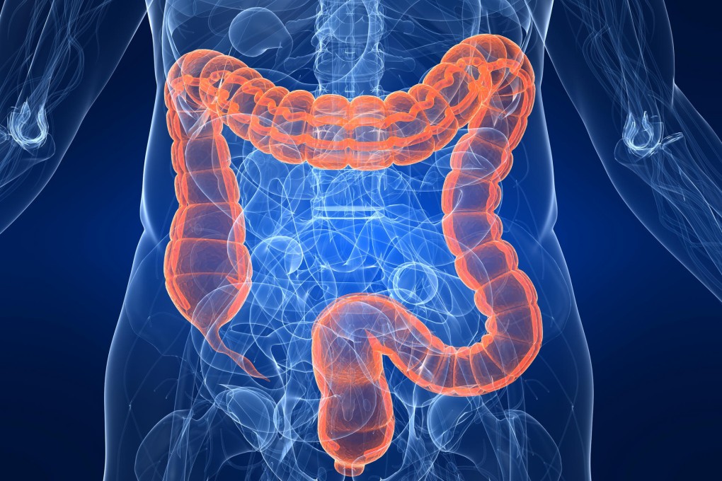 Health questions: are colon-cleansing products necessary for a healthy gut?