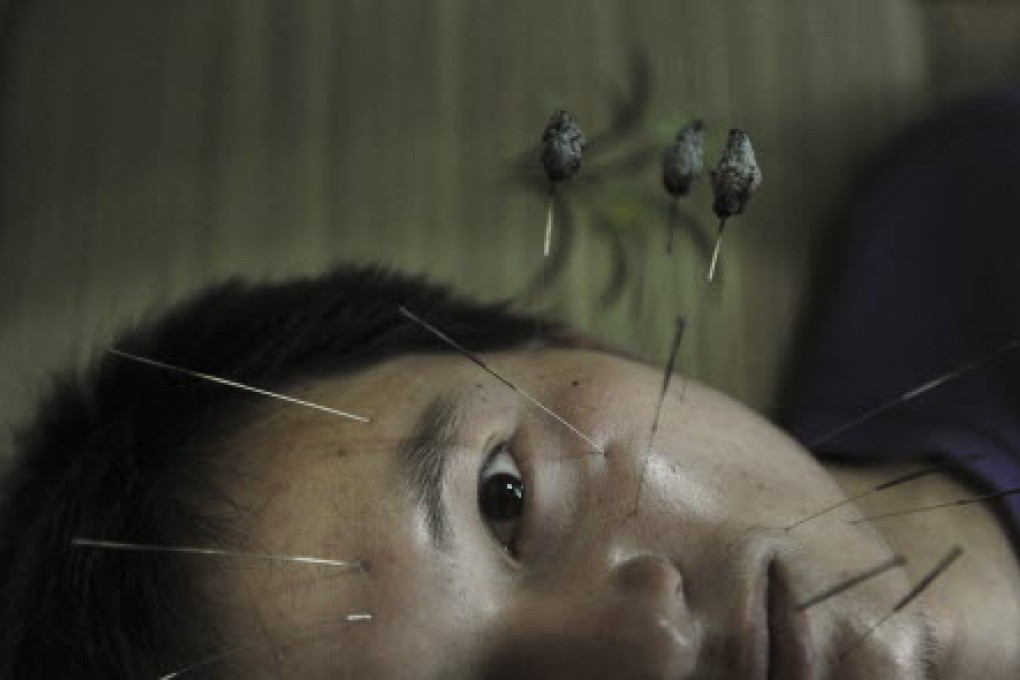 The number of smokers seeking help to quit through acupuncture has fallen, despite more mobile treatment clinics being set up across the city. Photo: Reuters