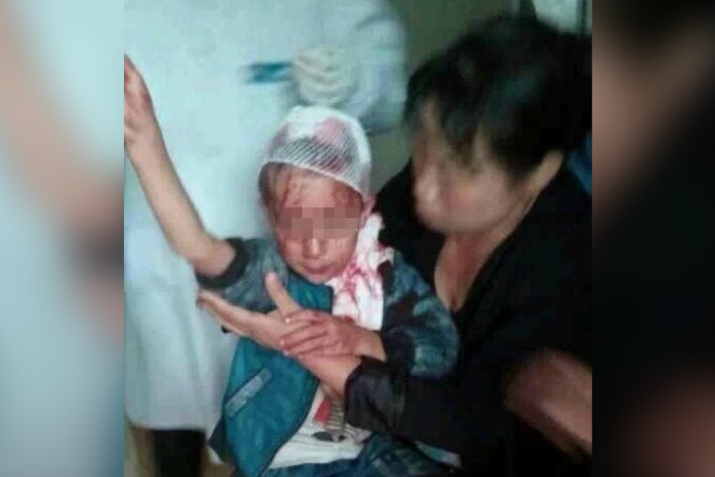 Two of the children were being treated for brain contusions, while two others were being treated for head lacerations. Photo: Weibo