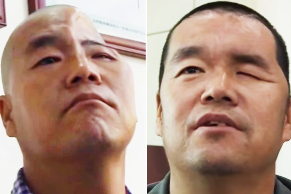 Before and after: Shaanxi farmer Hu crushed his skull in a fall, but doctors reconstructed his head with a prosthetic skull. Photos: Reuters and YouTube