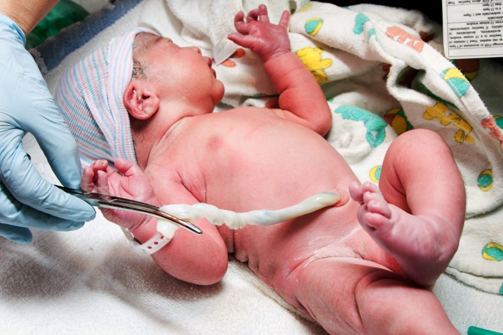 A Hospital Authority rule that bars mothers from storing their babies' umbilical cord blood for private use in stem-cell treatments has been condemned as a breach of human rights. Photo: SCMP Pictures