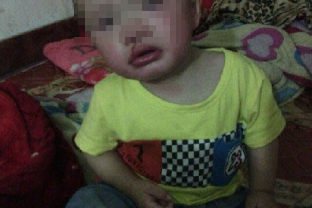 A photo of wounded boy posted by his father online. The father, from China's Shantou, claimed he beat and abused his son in revenge for his wife leaving him. Photo: Weibo