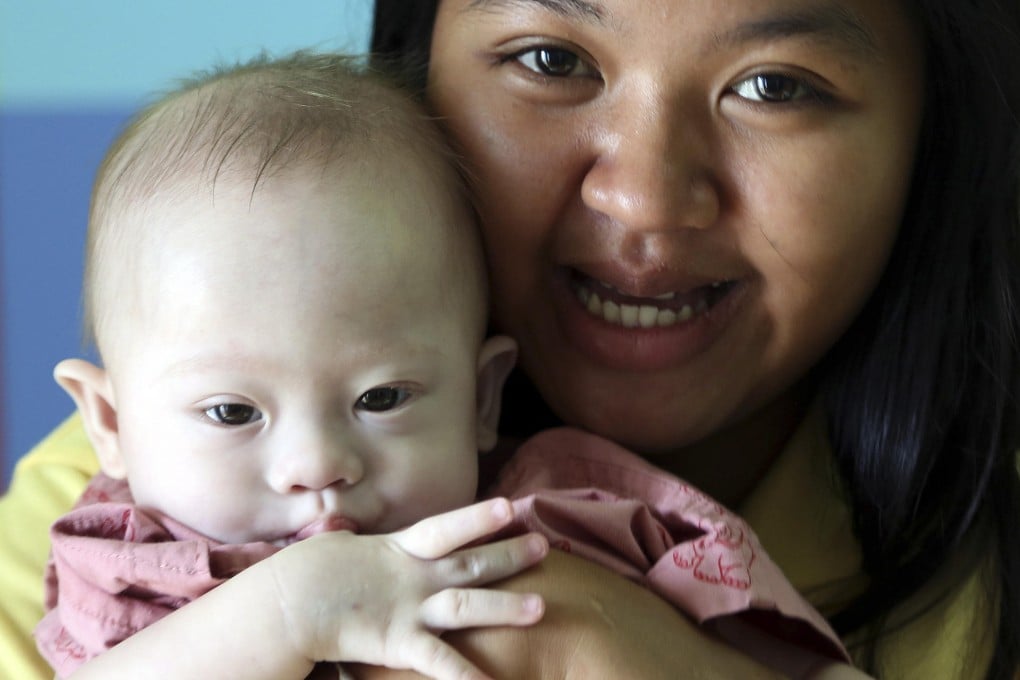 The Thai Down's baby. Photo: AP
