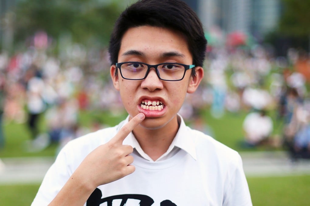 Chow Kar-ho shows his broken front tooth after the attack at Tai Wai MTR station. Photo: Sam Tsang
